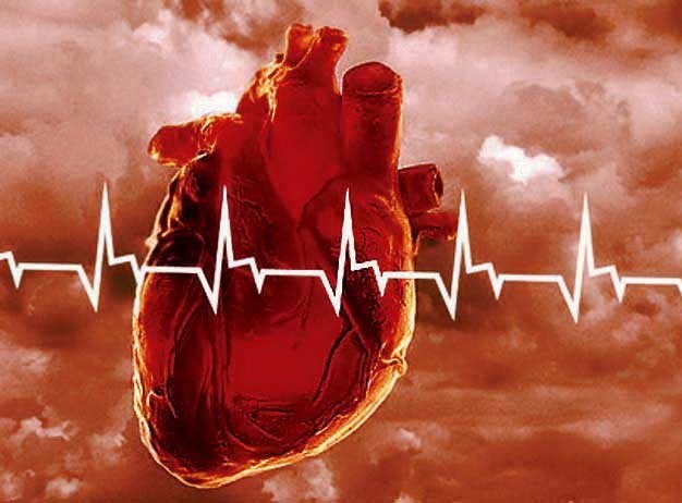 Quels sont les premiers signes d'une crise cardiaque?